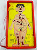 Operation Game - 1965 - Milton Bradley - Great Condition