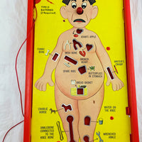 Operation Game - 1965 - Milton Bradley - Great Condition